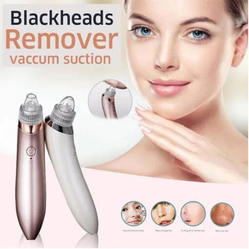 Blackhead Remover Pore Vacuum Facial Cleaner Suction Tool Pakistan